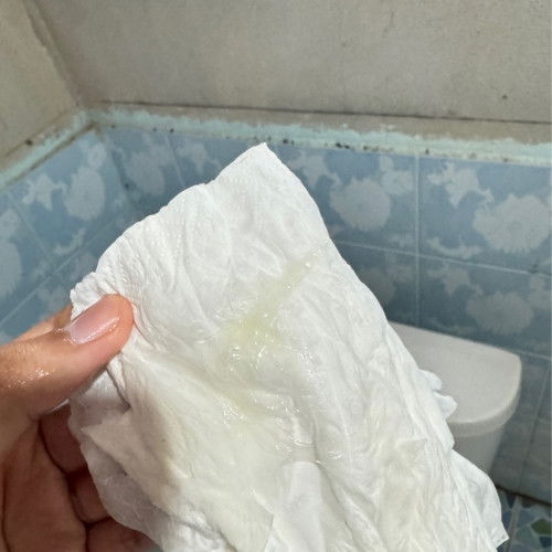 แบบนี้เรียกมูกมั้ยคะท้องได้34+1เมื่อคืนท้องแข็งทั้งคืนจะเป็นอะไรมั้ยคะควรไปหาหมอมั้ย