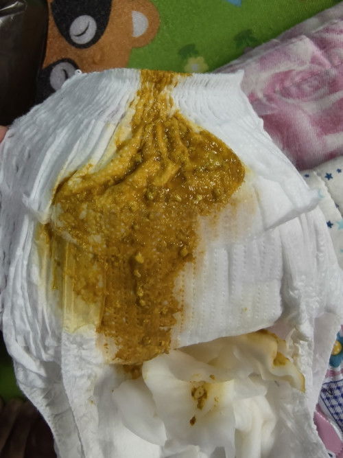 อึแบบนี้ปกติไหมแม่