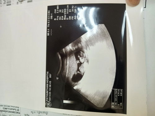 เมื่อวานไปฝากท้องครั้งแรก