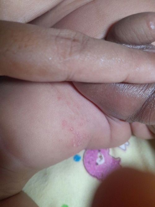 Kira kira ini kenapa nya ?
Obat nya apa?