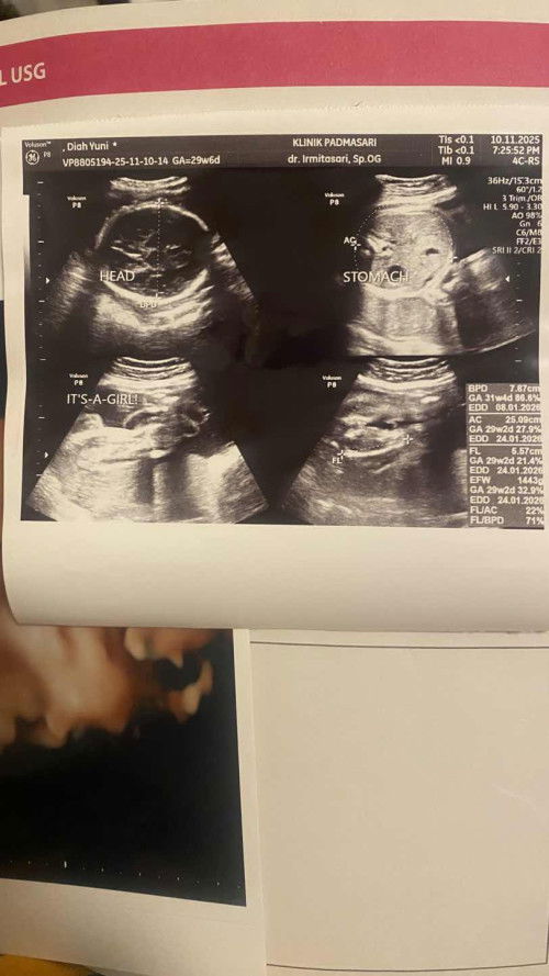 Perut kecil saat hamil