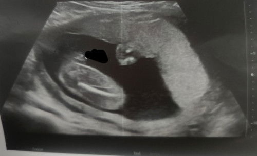 Gender Reveal pahula po