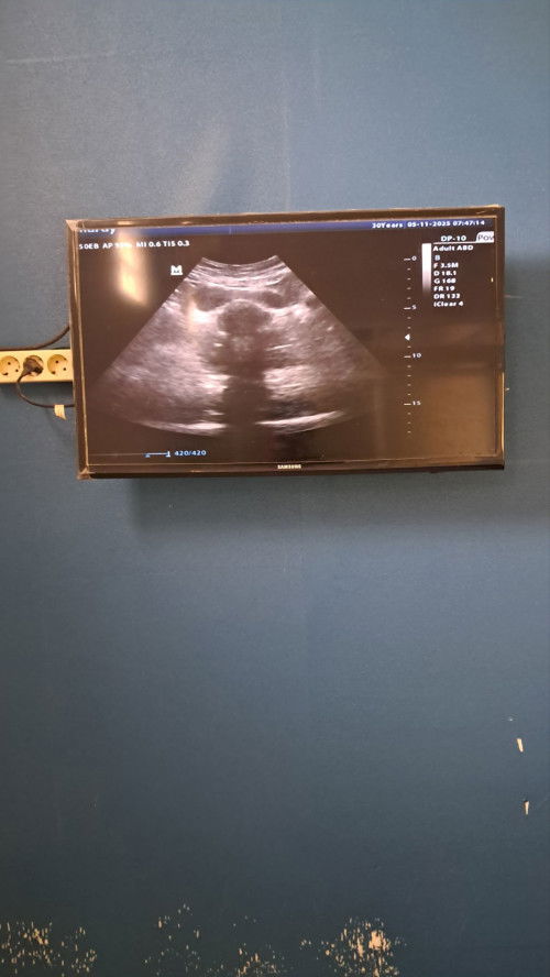 Apakah ini normal, kehamilan 6minggu baru terlihat kantongnya  saja