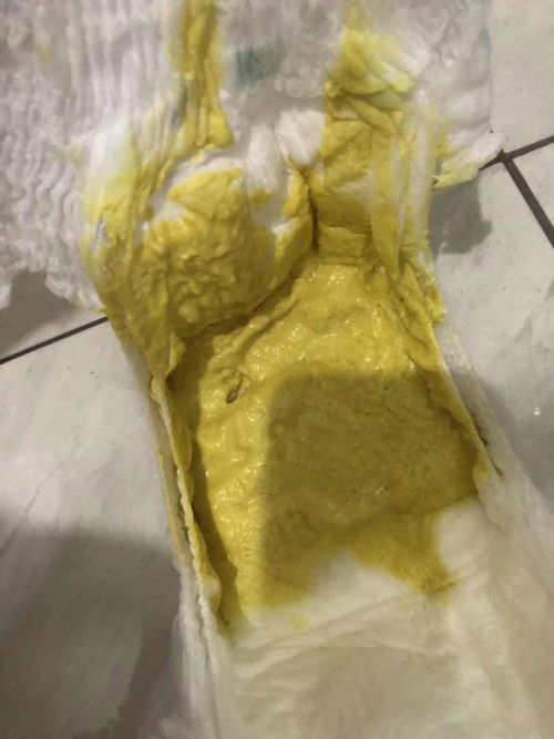 Pup bayi seperti ini normal g sih bund takut banget new mom soalnya