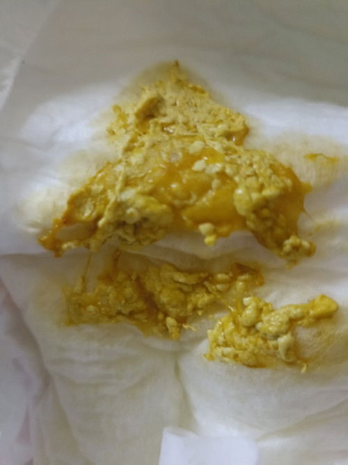 สอบถามแม่ๆ