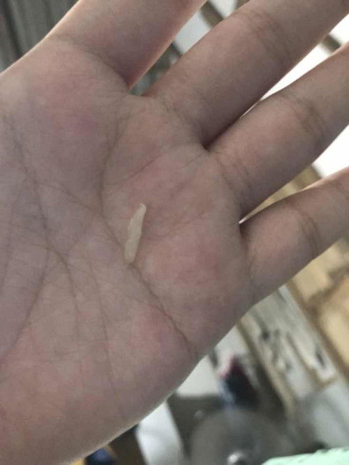 ขอสอบถามเเม่ๆหน่อยค่ะพอดีท้องเเรก