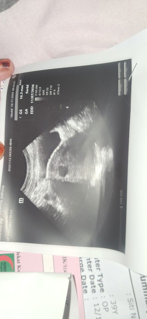 Mommy's kuatkan sy..da 4x scan still kantong kosong..ikutkn da 10w tp scan 5w4d..xmbesar kantong..