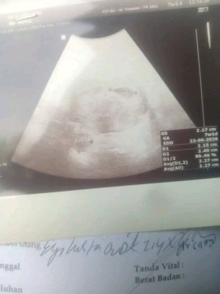 Berbahaya gak ya kira²?