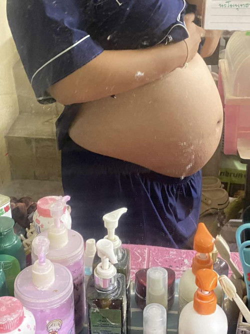 ท้องแบบนี้คิดว่าเป็นเพศไหนกันคะแม่ๆ