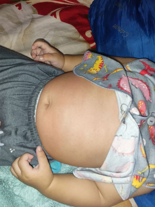 Muncul ruam merah di perut dan leher