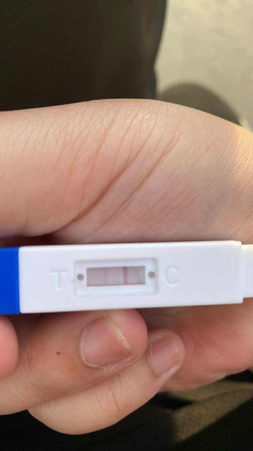 ประจำเดือนขาด