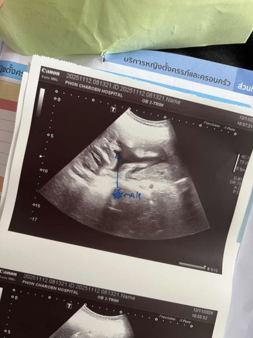 ผู้ชาย100%ไหมคะ