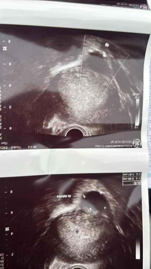 เครียดมากค่ะ🥹