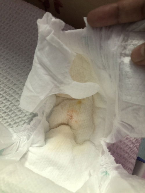 Normal ke kencing newborn macam ni? Ada pengalaman tak?