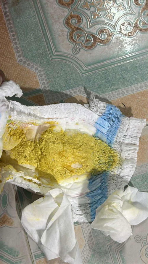 ถ่ายแบบนี้คือผิดปกติมั้ยคะ น้อง4เดือน