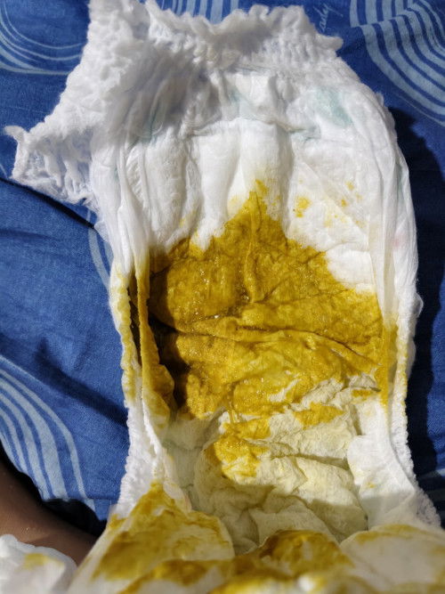 BAB bayi 5bulan asi mix sufor