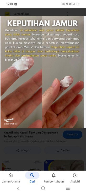 KEPUTIHAN TIDAK NORMAL SEMASA MENGANDUNG