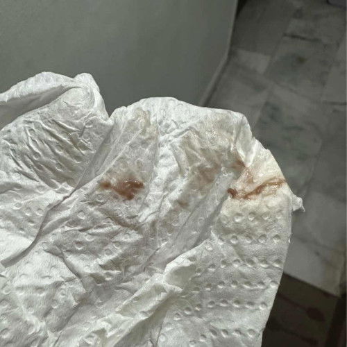 Implantation bleeding?