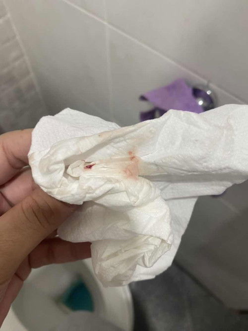 38w 6 d เลือดออกแบบนี้