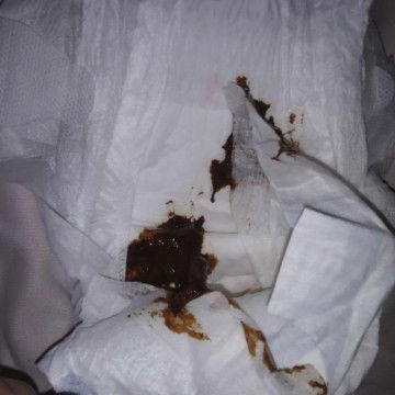 color ng dumi ni baby