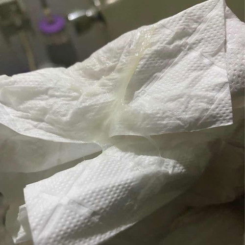 ใช่มูกใสมั้ยคะ แยกกไม่ออก 39wค่ะ