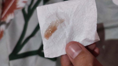 Hamil 39w 4d,  HPL 16 Nov