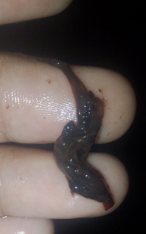 Ganto po itsura ng lumalabas pag nag mimiscarriage o may mas malaki pa dyan? .