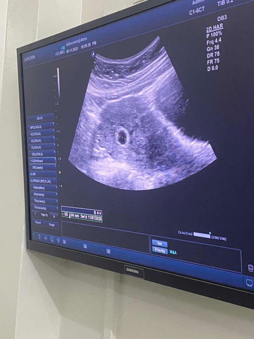 โดนรถชน เอกซ์เรย์ผ่านหน้าท้อง มีผลกับเด็กมากน้อยแค่ไหน