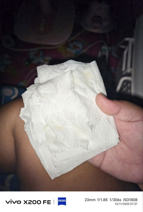 มูกใสหรือตกขาว