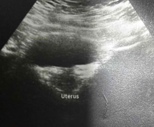 Get second opinion atau tak?