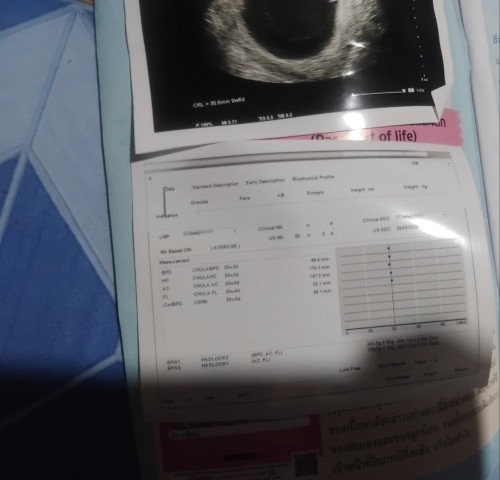 สอบถามเรื่องภาพนี้