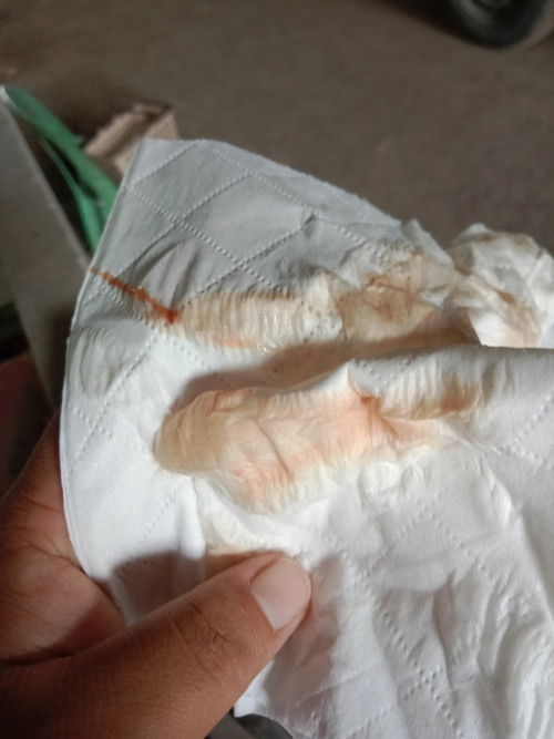 ท้อง38+6wแบบนี้ใกล้คลอกรึยังค่ะ