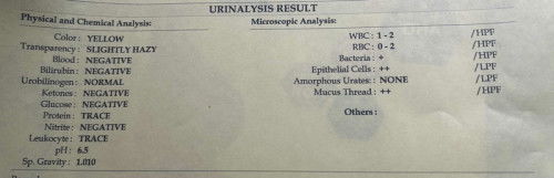 Urinalysis result