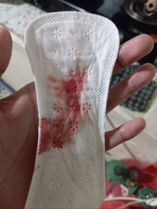 Nag spotting po ako  nag start sya kahapon mag papa trans v po ba ko para malaman lagay ng baby ko