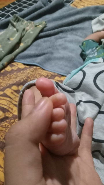 Kaki bayi 1 bulan tiba-tiba merah saat bangun tidur