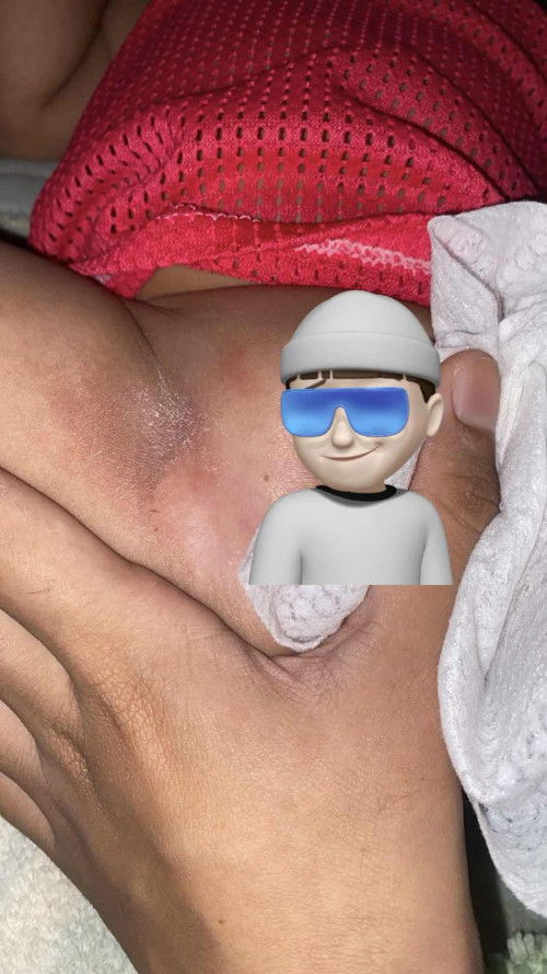 ใช้ยาอะไรทาได้บ้างคะ .