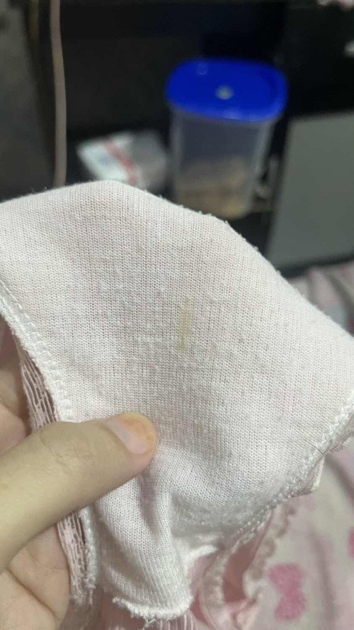 flek coklat/keputihan