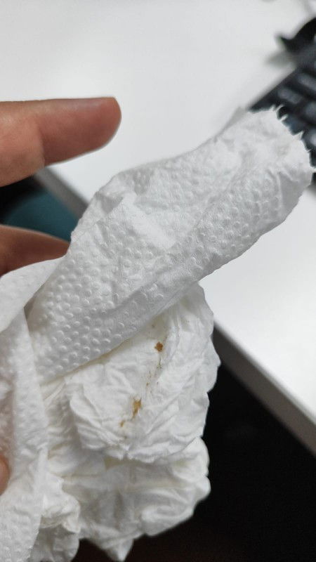 Hamil 28 minggu ini flek apa keputihan bu