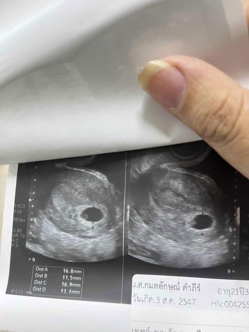 ไปหาหมอวันนี้มาค่ะ