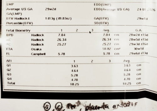 Bacaan air ketuban 29 minggu
