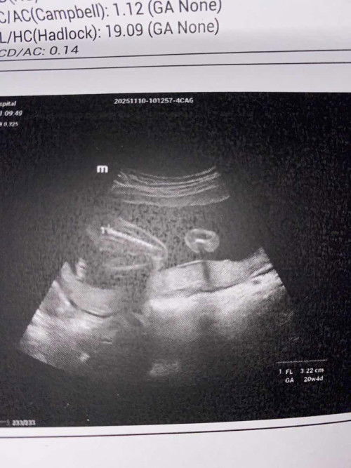 อันนี้คือส่วนไหนของน้องคะแม่บ้านนี้ดูไม่เป็นเลยทั้งท้องแรกและท้องสอง