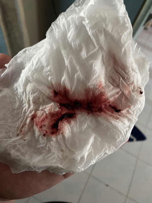 สอบถามแม่ๆหน่อยค่ะ