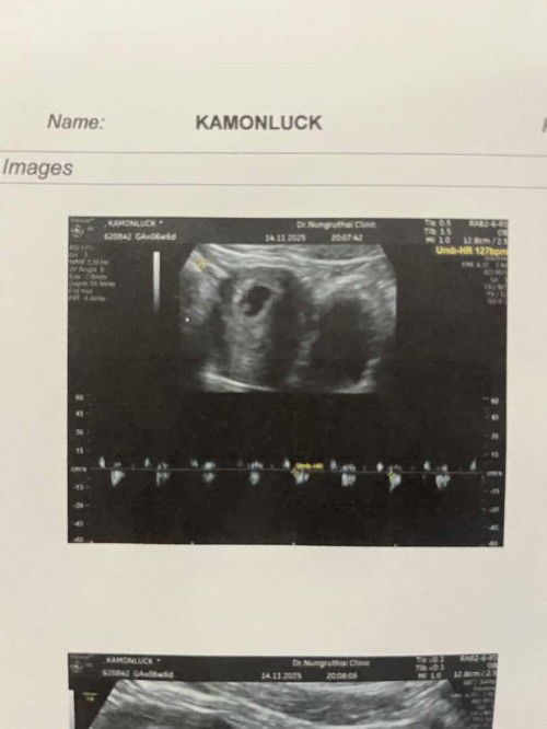 ขอบคุณคำตอบก่อนหน้านี้นะคะ