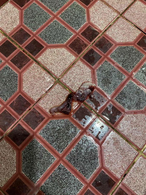 Cucuk depo bulan lepas tapi hari ni period keluar mcm kantung