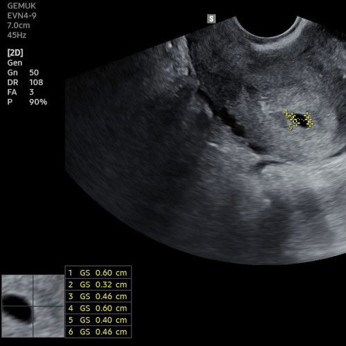 Baru terlihat kantungnya saja