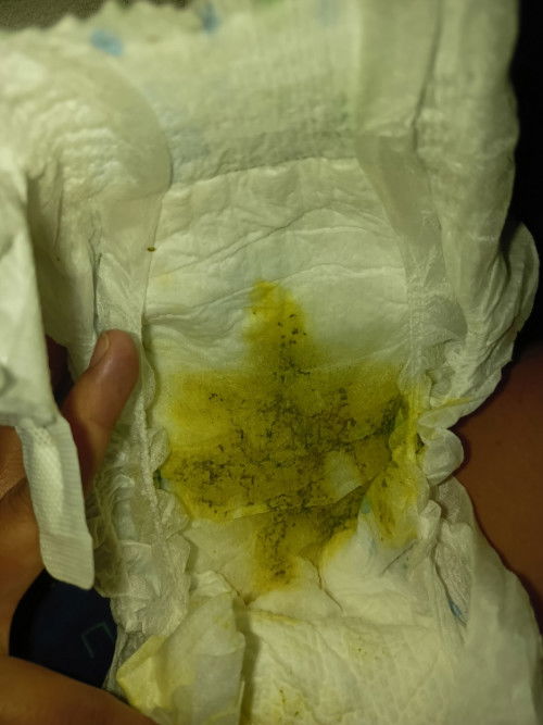 Good day mga miii, ask lang po Natural po ba Yung color green na poops sa 2 months old baby?? #Poops