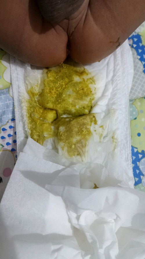 Bu ibu ini aman ga ya kalo pup bayi berlendir seperti ini untuk anak full asi?