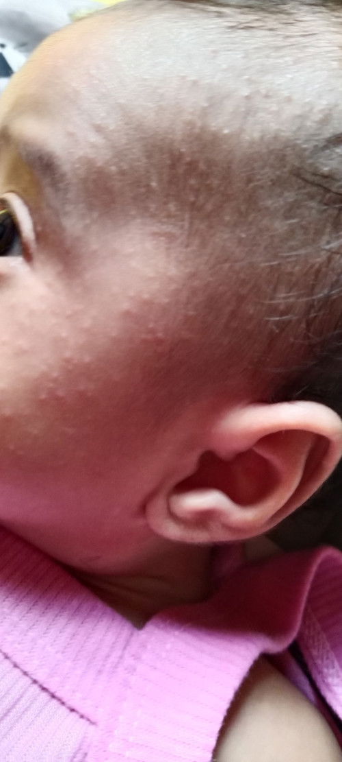 Bund, solusinya dong itu bisa ilangin ini