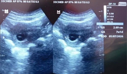 Bunda2 disini ada yg pernah ngalamin seperti ini gaa??