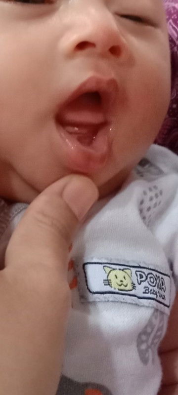 Titik putih dibawah lidah itu apa ya bund?